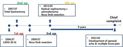 Case Report: Severe osteoporosis misunderstood by bone metastasis after total gastrectomy and multiple metastasectomy